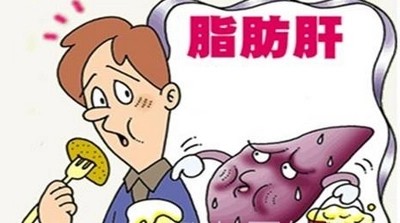 脂肪肝与喝酒有关？盘点脂肪肝的5大诱因