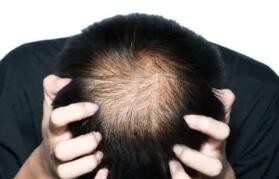 如果真的是脱发了 该做哪些检查？