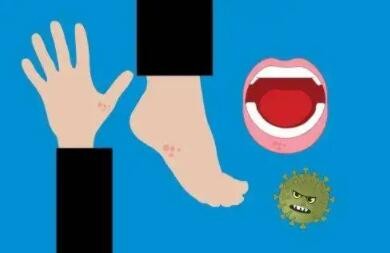 孩子患了手足口病怎么办？积极做好这5点好得快