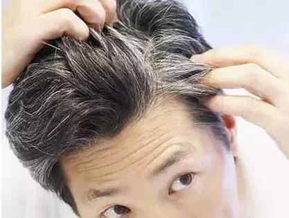 長白發(fā)是因?yàn)樯眢w缺乏營養(yǎng)？該如何改善